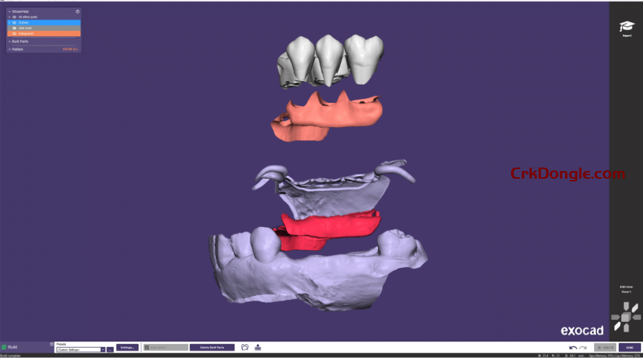 Exocad DentalCAD 3.2 Elefsina 9036