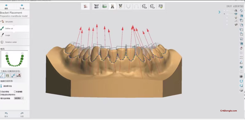 3shape Ortho System 2024