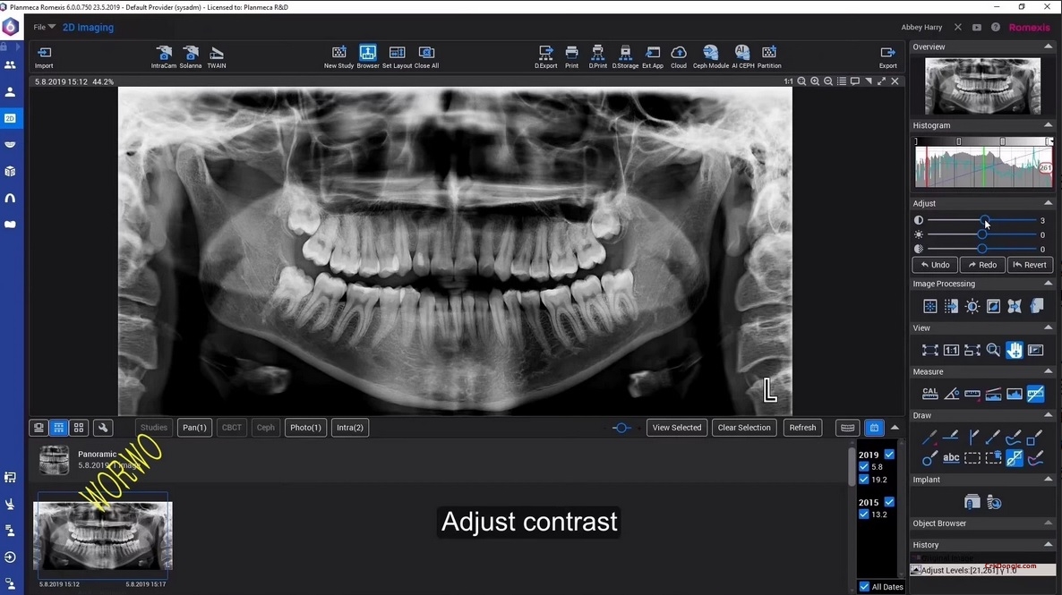 Planmeca Romexis 6.4.8