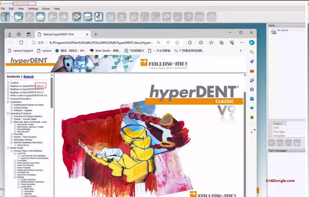 Hyperdent 10.0.2-Engineering software Download