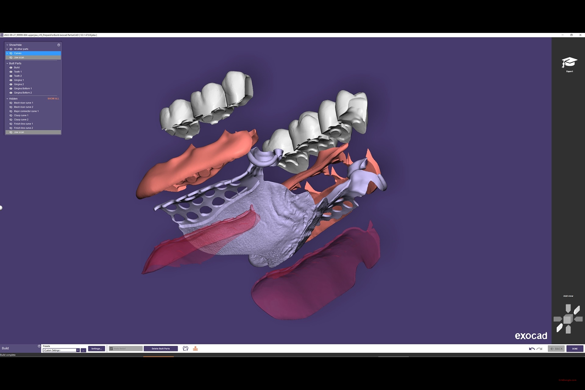 exocad partialcad 3.3-Engineering software Download