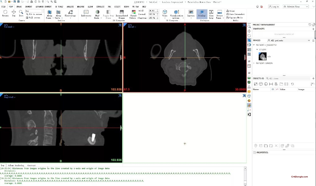 Materialise Mimics 28-Engineering software Download